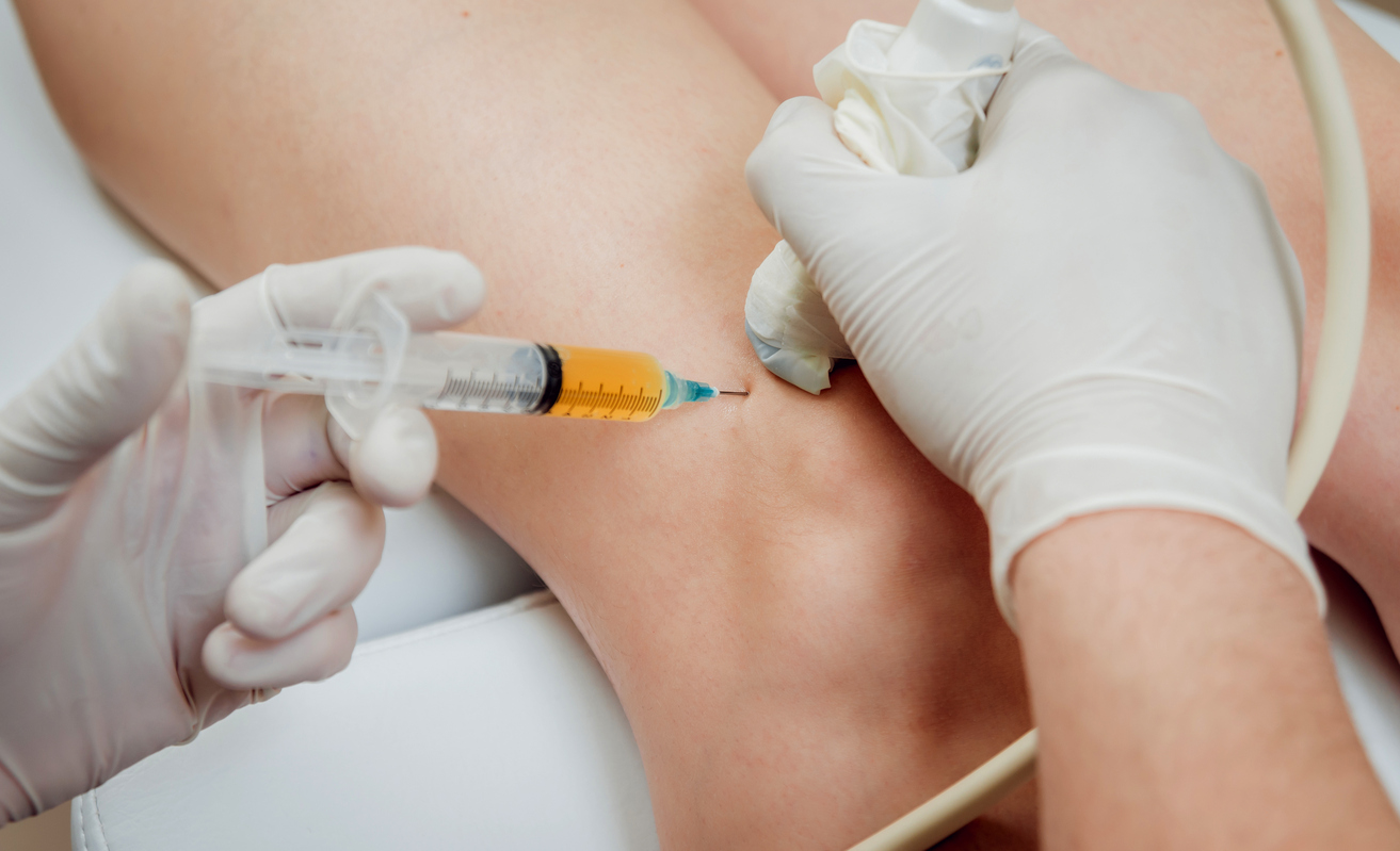 Ultrasound guidance
