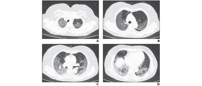 French medical imaging expert gives six tips to win against COVID-19